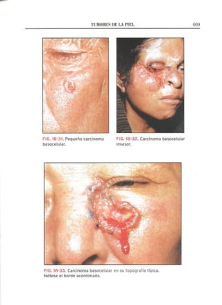 Lecciones de Dermatología