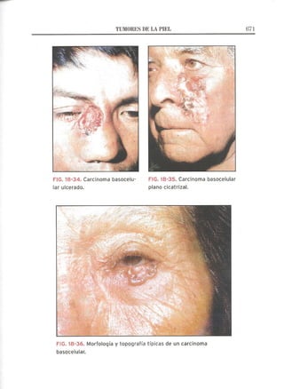 Lecciones de Dermatología