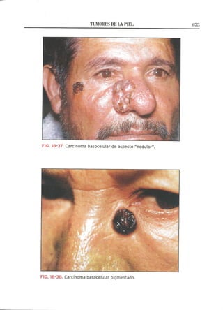 Lecciones de Dermatología