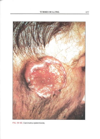 Lecciones de Dermatología