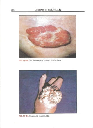 Lecciones de Dermatología