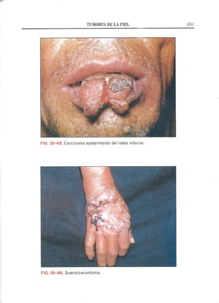 Lecciones de Dermatología