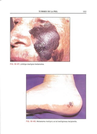 Lecciones de Dermatología