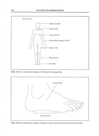 Lecciones de Dermatología