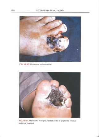 Lecciones de Dermatología