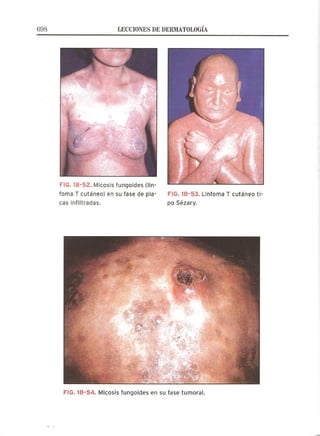 Lecciones de Dermatología