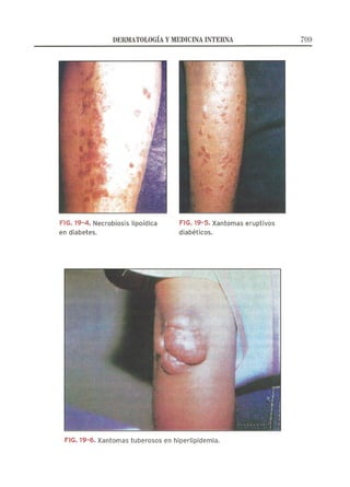 Lecciones de Dermatología