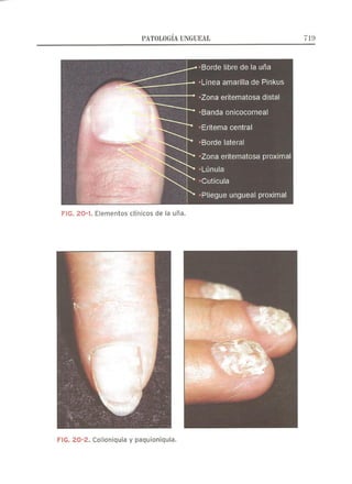 Lecciones de Dermatología