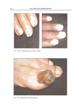 Lecciones de Dermatología