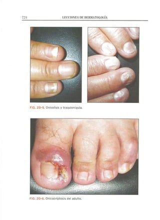 Lecciones de Dermatología