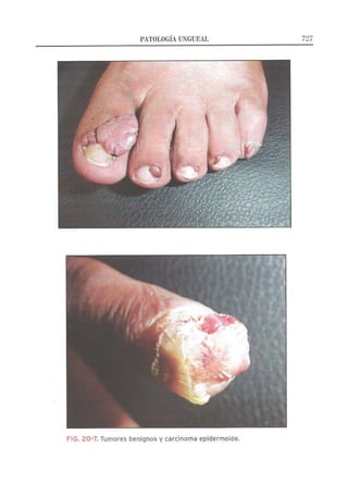 Lecciones de Dermatología