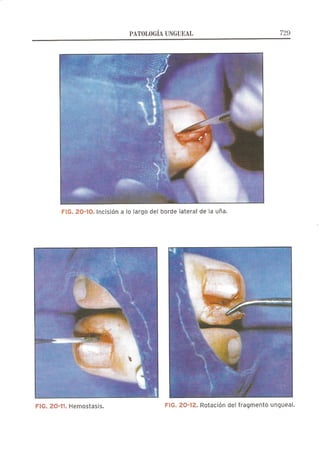 Lecciones de Dermatología