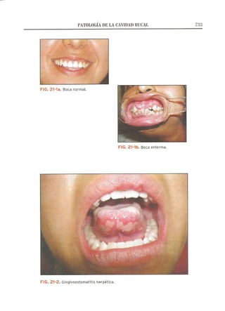 Lecciones de Dermatología