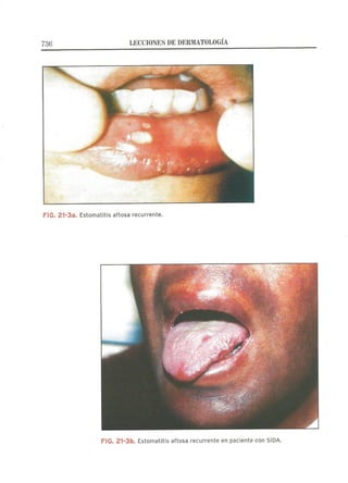 Lecciones de Dermatología