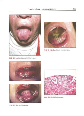 Lecciones de Dermatología