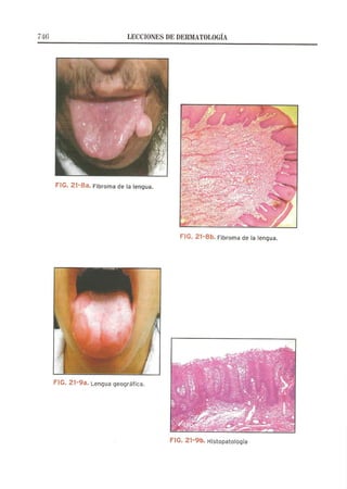 Lecciones de Dermatología