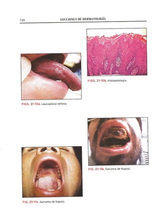 Lecciones de Dermatología