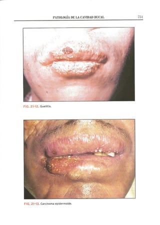 Lecciones de Dermatología