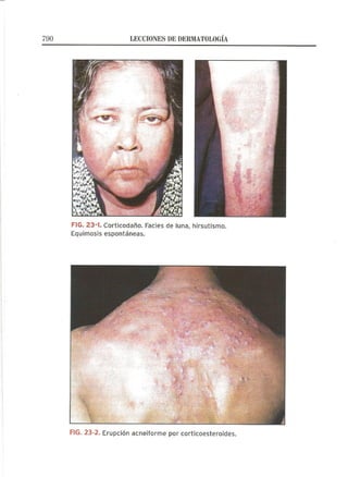 Lecciones de Dermatología