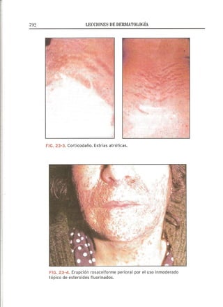 Lecciones de Dermatología