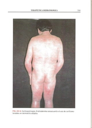 Lecciones de Dermatología