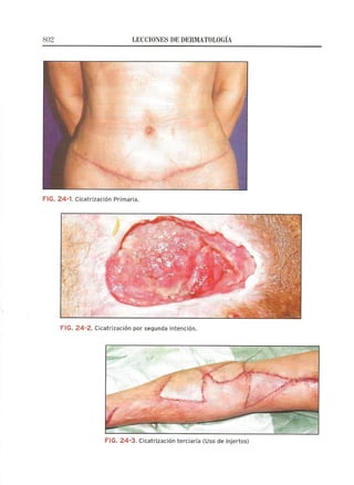 Lecciones de Dermatología