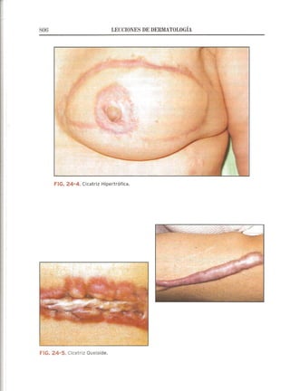 Lecciones de Dermatología