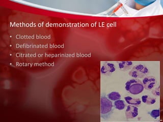 Methods of demonstration of LE cell
• Clotted blood
• Defibrinated blood
• Citrated or heparinized blood
• Rotary method