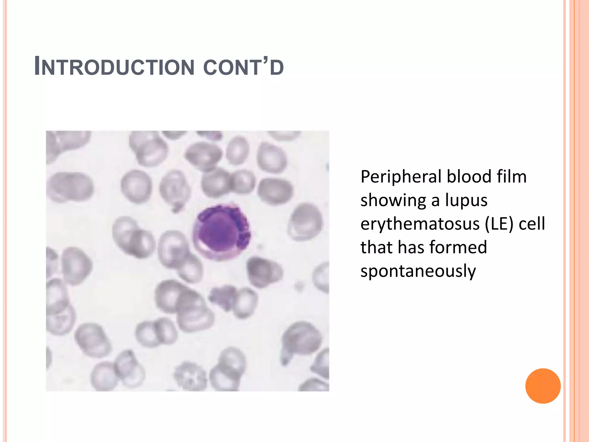 INTRODUCTION CONT’D
Peripheral blood film
showing a lupus
erythematosus (LE) cell
that has formed
spontaneously
 
