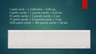 1 petit carré = 1 millimètre = 0,04 sec
5 petits carrés = 1 grands carrés = 0,20 sec
25 petits carrés = 5 grands carrés = 1 sec
75 petits carrés = 15 grands carrés = 3 sec
1500 petits carrés = 300 grands carrés = 60 sec
 