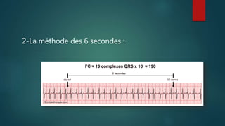 2-La méthode des 6 secondes :
 