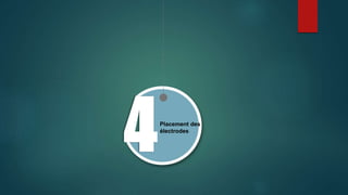 Placement des
électrodes
 