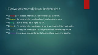 - Dérivations précordiales ou horizontales :
V1 (rouge) : 4e espace intercostal au bord droit du sternum.
V2 (jaune) : 4e espace intercostal au bord gauche du sternum.
V3 (vert) : sur le milieu de la ligne V2-V4.
V4 (brun) : 5e espace intercostal gauche sur la verticale médio-claviculaire.
V5 (noir) : 5e espace intercostal sur la ligne axillaire antérieure gauche.
V6 (mauve) :5e espace intercostal sur la ligne axillaire moyenne gauche.
 