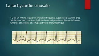 La tachycardie sinusale
°° C’est un rythme régulier et sinusal de fréquence supérieure à 100/ mn chez
l'adulte, avec des complexes QRS fins.Cette tachycardie est liée aux influences
humorale et nerveuse et à l’hyperactivité orthosympathique
 