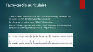 Tachycardie auriculaire
°° Elle se définit par une activité auriculaire ectopique régulière mais non
sinusale ( elle naît dans le myocarde auriculaire)
La fréquence est rapide entre 100 et 250 par minute
Plus de trois extrasystoles auriculaires consécutives entraînant un rythme
cardiaque à une fréquence supérieur à 100 par minute.
 