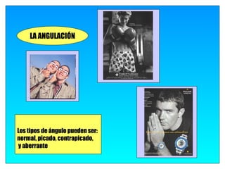 LA ANGULACIÓN




Los tipos de ángulo pueden ser:
normal, picado, contrapicado,
y aberrante
 