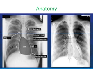 Comprehensive Guide to Chest X-Ray Interpretation and Anatomy | PDF