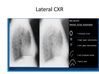 Comprehensive Guide to Chest X-Ray Interpretation and Anatomy | PDF