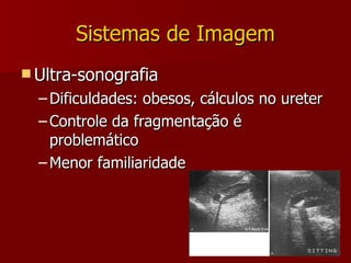 Sistemas de Imagem Ultra-sonografia Dificuldades: obesos, cálculos no ureter Controle da fragmentação é problemático Menor familiaridade 