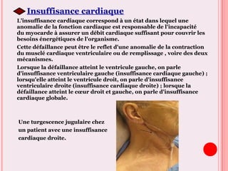 Insuffisance cardiaque
L’insuffisance cardiaque correspond à un état dans lequel une
anomalie de la fonction cardiaque est responsable de l'incapacité
du myocarde à assurer un débit cardiaque suffisant pour couvrir les
besoins énergétiques de l'organisme.
Cette défaillance peut être le reflet d'une anomalie de la contraction
du musclé cardiaque ventriculaire ou de remplissage , voire des deux
mécanismes.
Lorsque la défaillance atteint le ventricule gauche, on parle
d'insuffisance ventriculaire gauche (insuffisance cardiaque gauche) ;
lorsqu'elle atteint le ventricule droit, on parle d'insuffisance
ventriculaire droite (insuffisance cardiaque droite) ; lorsque la
défaillance atteint le cœur droit et gauche, on parle d'insuffisance
cardiaque globale.
Une turgescence jugulaire chez
un patient avec une insuffisance
cardiaque droite.
 