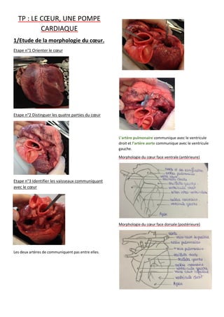 TP : LE CŒUR, UNE POMPE
CARDIAQUE
1/Etude de la morphologie du cœur.
Etape n°1 Orienter le cœur
Etape n°2 Distinguer les quatre parties du cœur
Etape n°3 Identifier les vaisseaux communiquant
avec le cœur
Les deux artères de communiquent pas entre elles.
L’artère pulmonaire communique avec le ventricule
droit et l’artère aorte communique avec le ventricule
gauche.
Morphologie du cœur face ventrale (antérieure)
Morphologie du cœur face dorsale (postérieure)
 