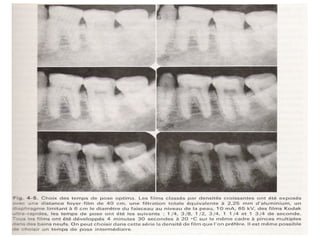 Le Contraste Radiologique et son effet sur l'interpretation ...