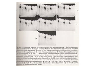 Le Contraste Radiologique et son effet sur l'interpretation ...