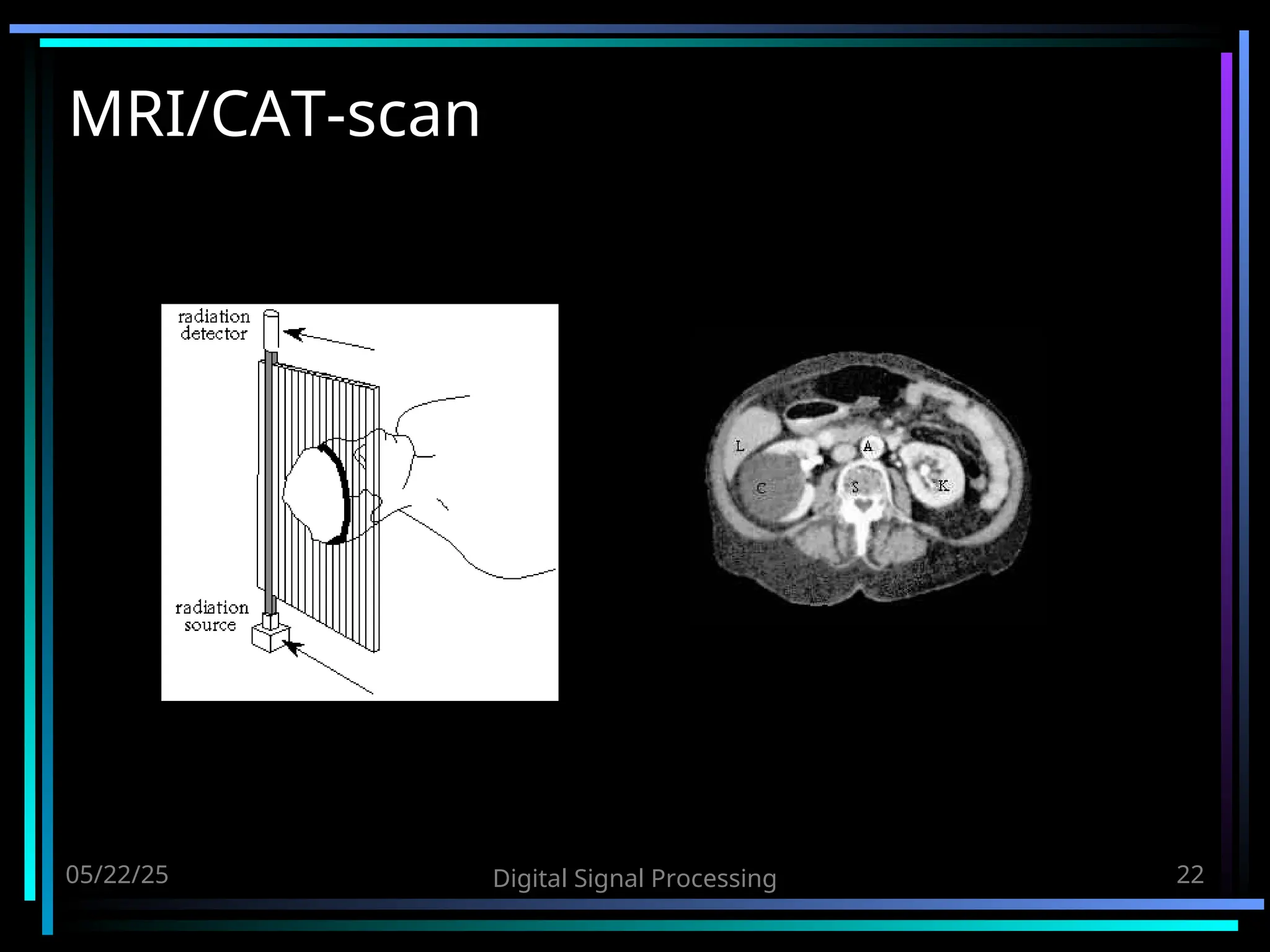 05/22/25 Digital Signal Processing 22 MRI/CAT-scan 