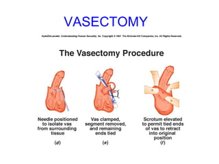 Lect -male reproductive organs | PPT
