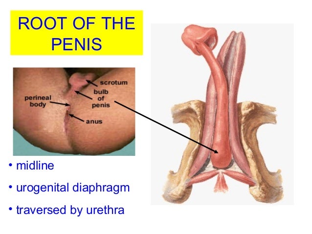 The complex is due to a small penis