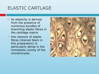 ELASTIC CARTLAGE
 its elasticity is derived
from the presence of
numerous bundles of
branching elastic fibres in
the cartilage matrix
 this network of elastic
fibres (stained black in
this preparation) is
particularly dense in the
immediate vicinity of the
chondrocytes.
 