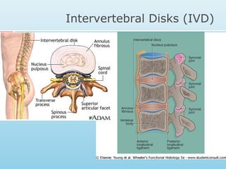 Intervertebral Disks (IVD)
 