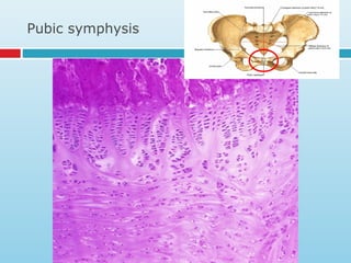 Pubic symphysis
 