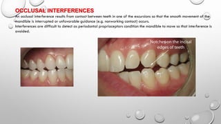 Lateral Excursion Interferences Lect.7. Tooth bleaching and occlusion | PDF